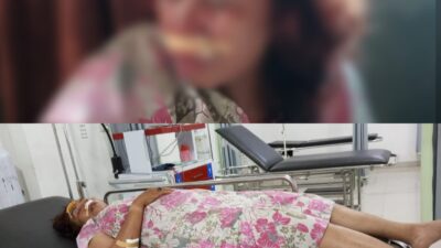 Malam Lebaran Berujung Petaka: Ketua GWI Tubaba Terluka Parah Diduga Akibat Jalan Rusak